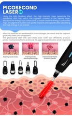 4-in-1 Diode Laser Pico IPL RF Hair Removal Skin Rejuvenation Tattoo Removal