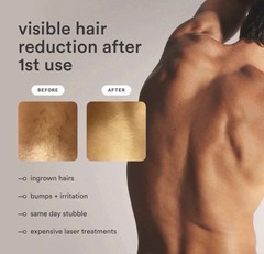 Nood The Flasher Pro IPL Laser Hair Removal Device Gloss White MSRP $399