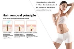 1064/755/810nm Painless Diode Laser Hair Removal Machine Body Skin Rejuvenation