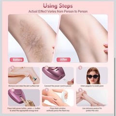 2026 NEW Playexen IPL Hair Removal System Painless Full Body Factory Sealed