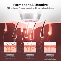 V8S Diode Laser Hair Removal Device – Safe, Professional Results at Home