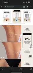 INIA Laser Hair Removal Device for Women and Men INIA Fond Hair Remover