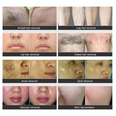 PRO IPL OPT LASER PERMANENT Hair Removal RF Skin Rejuvenation Beauty Machine