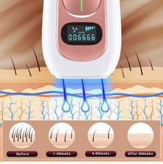 IPL Hair Removal, 999,900 Flashes Permanent Laser Hair Removal