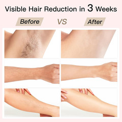 Laser Hair Removal, IPL Hair Removal with Painless Ice-Cooling, 2-In-1 Face SR