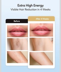Laser Hair Removal with Ice Cooling Care Function for Women IPL JD-TM016