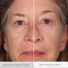 Serious Skincare INSTA-TOX Instant Wrinkle Smoothing 0.75 Fl Oz (Pack of 2)