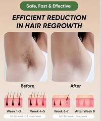 XSOUL IPL Hair Removal for Women&Men Permanent Hair Removal-Armpits,legs,PRIVATE