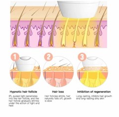 Fuzz OFF Skin 600000 IPL Permanent Laser Hair Removal (Body, Face, Leg)