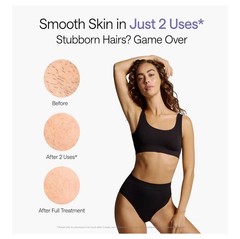 BRAND NEW UNOPENED Ulike IPL Laser Hair Removal Device Air 10 NIB