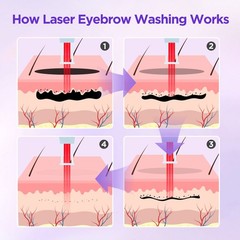 Professional 2 In 1 Diode Laser Hair Removal Machine Picosecond Tattoo Removal