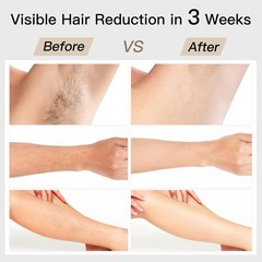 Advanced IPL Hair Removal Device, Visible Results in 3 Weeks