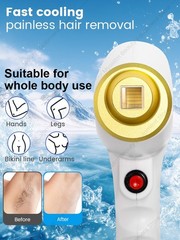Diode Laser Hair Removal Machine 755nm 808nm 1064nm Painless Home Salon Use