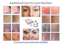 Bio Avance Laser Hair Removal System for Medipsa & Salon Use Machine with Kit.