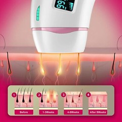 IPL Hair Removal for Women and Men Permanent Painless Laser White
