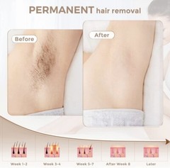 LVARA Permanent Laser Hair Removal Device for Women Men – FDA Cleared