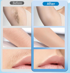 Hair Removal Device for Women & Men IPL Necool Model FZ-613 NEW