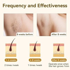 GERY IPL Hair Remover Device Flash Fast Laser, Whole Body, Bikini Permanent New!