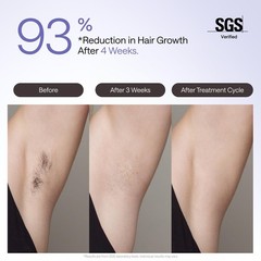 Ulike Laser Hair Removal Device Air 4 Ipl Gift for Women and Men, Ice Purple