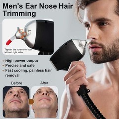 Laser Hair Removal Whitening Rejuvenation Machine Diode Laser Machine Equipment