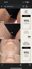 INIA Laser Hair Removal Device for Women and Men INIA Fond Hair Remover