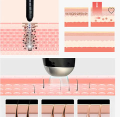 4In1 Professional Pico Laser Diode Hair Removal Skin Rejuvenation Machine