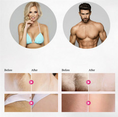 AT HOME Laser IPL Hair Removal // 600,000 pulses // Portable Handheld Full Body