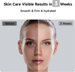 JOVS Laser Hair Removal, 37°F Painless Hair Removal Device with Sapphire Ice-…