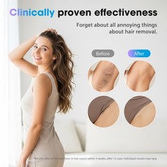 IPL Laser Hair Removal Device for Women & Men – Home 45°F Hot Pink