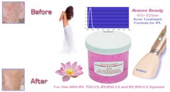 Acne Formula 400-505nm Cooling & Coupling Gel for Laser IPL Machines, with Aloe.