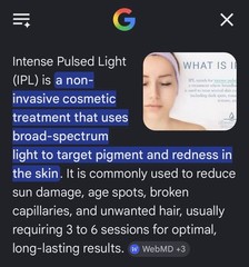 IPL Intense Pulsed Light Hair Removal System