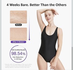 Vitaly Sapphire Ice-Cooling IPL Hair Removal for Fast Full-Body Results New