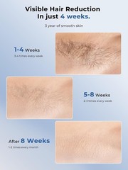 Ubroo 2026 Laser Hair Removal with 5℃ Ice Cooling, Hand-Held Shaving Device IPL
