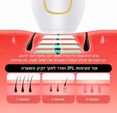 ipl hair removal