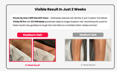 IPL Laser Hair Removal for Women and Men SALLOOT Trinity i15 Pro