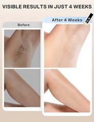 IPL Hair Removal Laser Permanent Body Painless Device (White & Black) See Descr