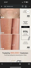 INIA Laser Hair Removal Device for Women and Men INIA Fond Hair Remover