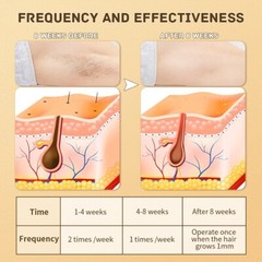 IPL Hair Removal Device for Women & Men – Lasting Hair Regrowth Reduction