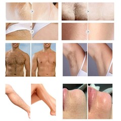 2026 Ice Titanium Soprano Permanent Painless Diode Laser Hair Removal Machine