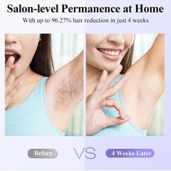 Advanced Hair Removal with Sapphire Cooling