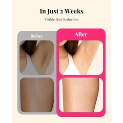 IPL Hair Removal Device 999999 Flashes Permanent Hair Remover at Home