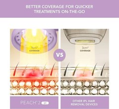 FOREO Peach Go 2 IPL Hair Removal Device + Cooling Prep Gel Laser Treatment New