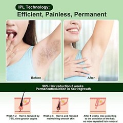 IPL Laser Permanent Hair Removal Device Facial Legs Arms Whole Body Treatment
