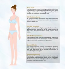 Permanent OPT IPL Laser Hair Removal Machine Whitening Skin Rejuvenation M22