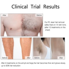 999,999 Flashes IPL Hair Removal Laser Permanent Body epilator Painless Device