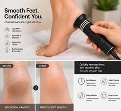 IPL Laser Hair Removal With Cooling System, at-Home Permanent for Women and Men
