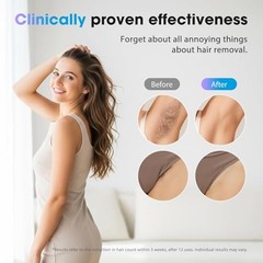 IPL Laser Hair Removal Device for Women & Men – Home 45°F Ice White Rose Gold