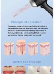 755 808 1064nm Fast hair Epilator Diode laser hair Removal Machine Ice Titanium
