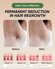 XSOUL At-Home IPL Hair Removal for Women and Men Permanent