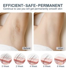Veme V601 Home Use Ipl hair Removal With Cold Compress New